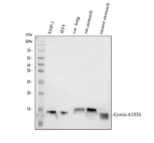 Anti-Cystatin A/CSTA Antibody Picoband® Boster Bio