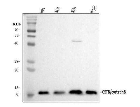 Anti-Stefin B/CSTB Antibody Picoband® Boster Bio