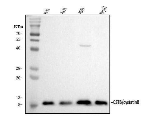 Anti-Stefin B/CSTB Antibody Picoband® Boster Bio