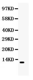 Anti-MCP1/CCL2 Antibody Picoband® Boster Bio