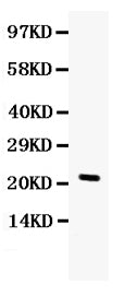 Anti-G-CSF/CSF3 Antibody Picoband® Boster Bio