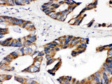 Anti-Lipoamide Dehydrogenase/DLD Antibody Picoband® Boster Bio
