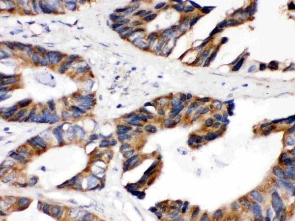 Anti-Lipoamide Dehydrogenase/DLD Antibody Picoband® Boster Bio