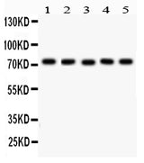 Anti-EED Antibody Picoband® Boster Bio