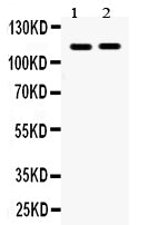 Anti-Eph receptor A5/EPHA5 Antibody Picoband® Boster Bio