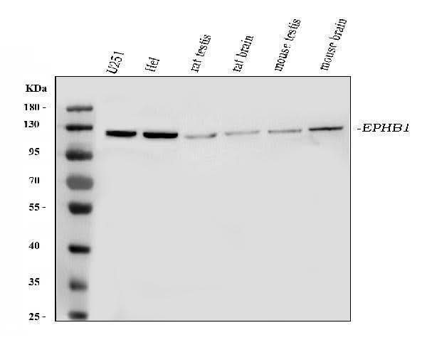 Anti-Eph receptor B1/EPHB1 Antibody Picoband® Boster Bio