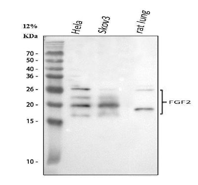 Anti-FGF2 Antibody Picoband® Boster Bio