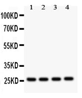Anti-Flt3 ligand/FLT3LG Antibody Picoband® Boster Bio
