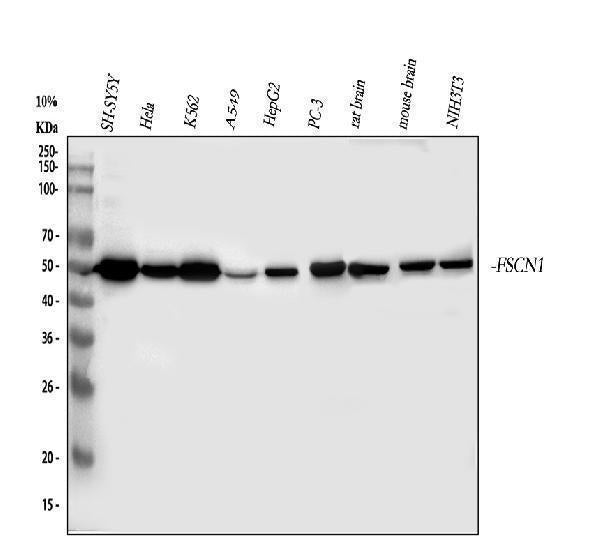 Anti-Fascin/FSCN1 Antibody Picoband® Boster Bio