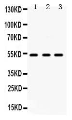 Anti-5HT2A Receptor/HTR2A Antibody Picoband® Boster Bio