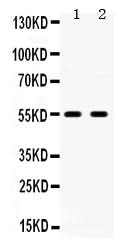 Anti-5HT2B Receptor/HTR2B Antibody Picoband® Boster Bio