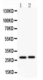 Anti-IGFBP1 Antibody Picoband® Boster Bio