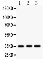Anti-IGFBP2 Antibody Picoband® Boster Bio