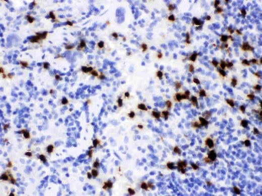 Anti-Lipocalin 2/LCN2 Antibody Picoband® Boster Bio