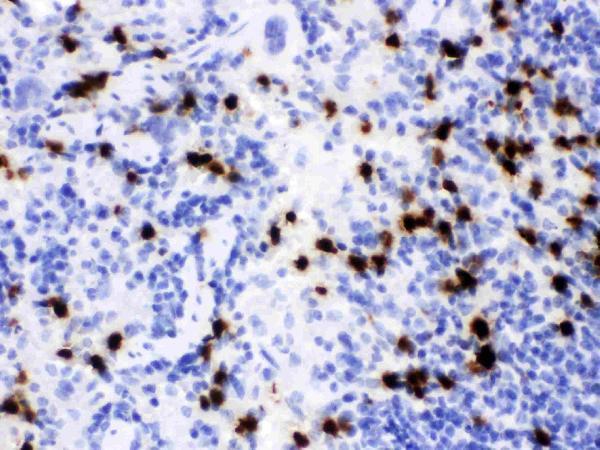 Anti-Lipocalin 2/LCN2 Antibody Picoband® Boster Bio