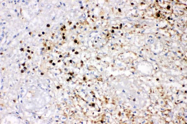 Anti-IL8/CXCL8 Antibody Picoband® Boster Bio