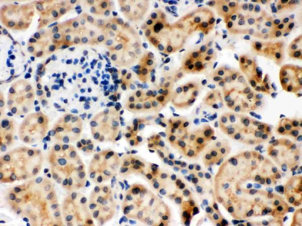 Anti-Hsc70/HSPA8 Antibody Picoband® Boster Bio