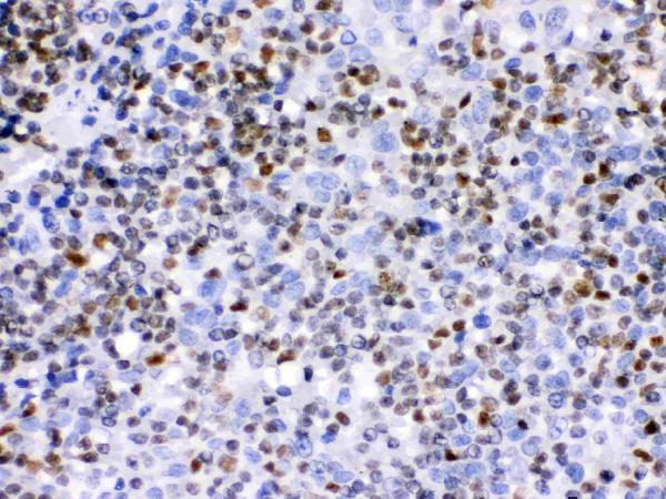 Anti-Ikaros/IKZF1 Antibody Picoband® Boster Bio