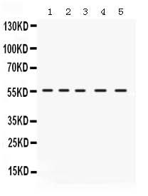 Anti-IRF5 Antibody Picoband® Boster Bio