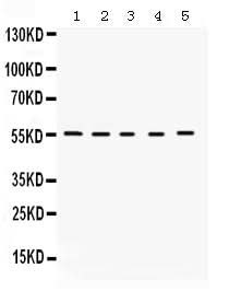 Anti-KCNA3 Antibody Picoband® Boster Bio