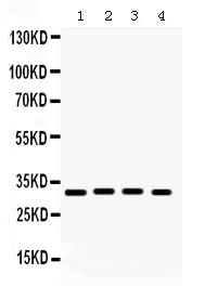 Anti-KChIP2/KCNIP2 Antibody Picoband® Boster Bio