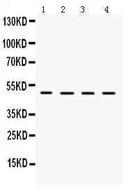 Anti-LCAT Antibody Picoband® Boster Bio