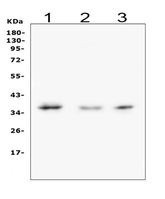 Anti-Galectin 8/LGALS8 Antibody Picoband® Boster Bio