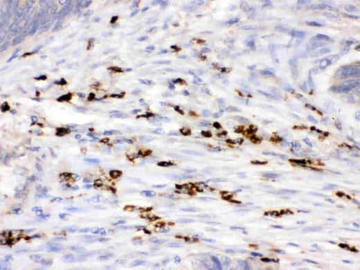 Anti-Lysozyme/LYZ Antibody Picoband® Boster Bio