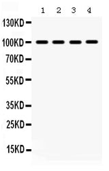 Anti-MAPK6 Antibody Picoband® Boster Bio