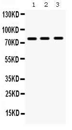Anti-MMP9 Antibody Picoband® Boster Bio