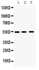 Anti-MMP10 Antibody Picoband® Boster Bio