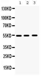 Anti-MMP10 Antibody Picoband® Boster Bio