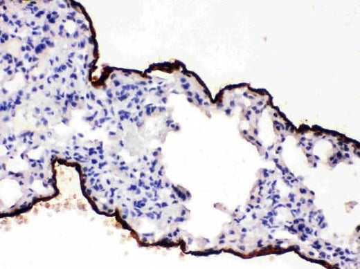 Anti-Mesothelin/MSLN Antibody Boster Bio