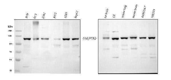 Anti-FAK/PTK2 Antibody Picoband® Boster Bio