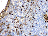 Anti-S100A9 Antibody Picoband® Boster Bio