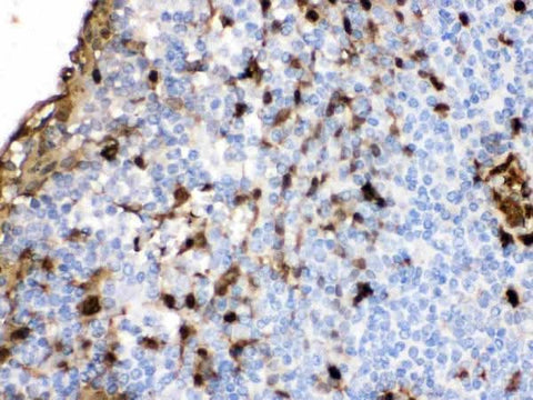 Anti-S100A9 Antibody Picoband® Boster Bio