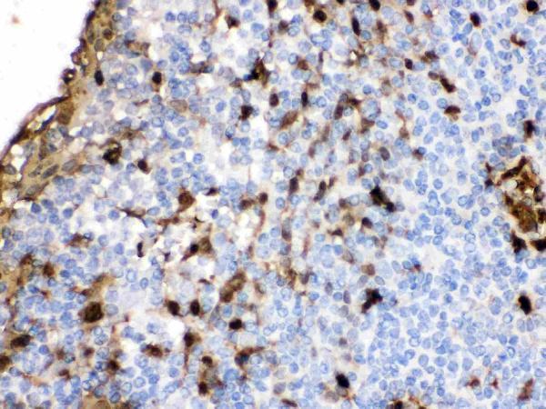 Anti-S100A9 Antibody Picoband® Boster Bio