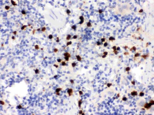 Anti-S100A9 Antibody Picoband® Boster Bio