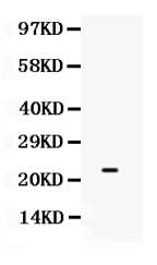 Anti-SECTM1/Sectm1b Antibody Picoband® Boster Bio
