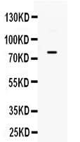 Anti-GRK3/ADRBK2 Antibody Picoband® Boster Bio