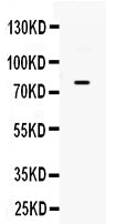Anti-GRK3/ADRBK2 Antibody Picoband® Boster Bio