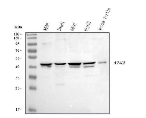 Anti-AIM2 Antibody Picoband® Boster Bio