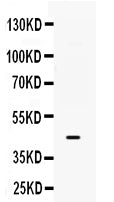 Anti-B3GNT8 Antibody Picoband® Boster Bio