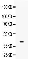 Anti-BMP6 Antibody Picoband® Boster Bio