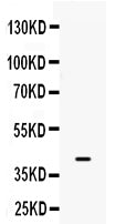 Anti-BMP6 Antibody Picoband® Boster Bio