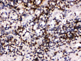 Anti-CD22 Antibody Picoband® Boster Bio