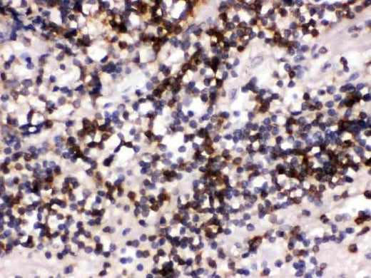 Anti-CD22 Antibody Picoband® Boster Bio