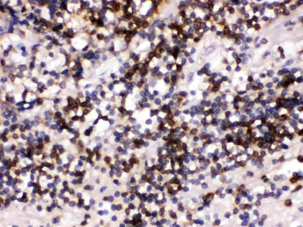 Anti-CD22 Antibody Picoband® Boster Bio