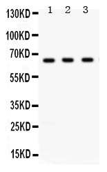 Anti-Chk2/CHEK2 Antibody Picoband® Boster Bio