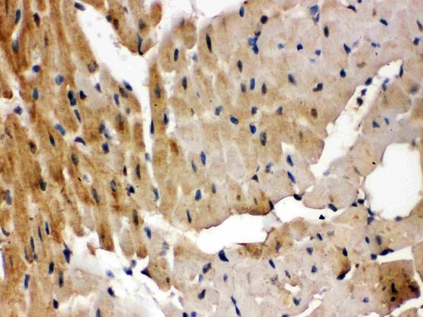 Anti-GRK5 Antibody Picoband® Boster Bio